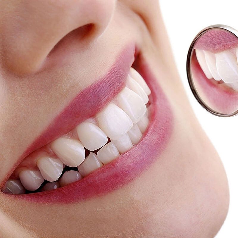 img-special-Teeth-Whitening